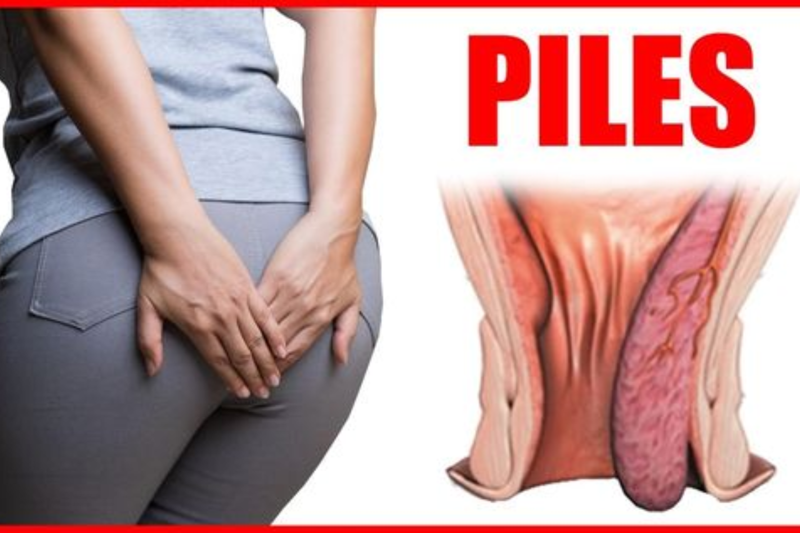 piles surgery indore, piles doctor indore