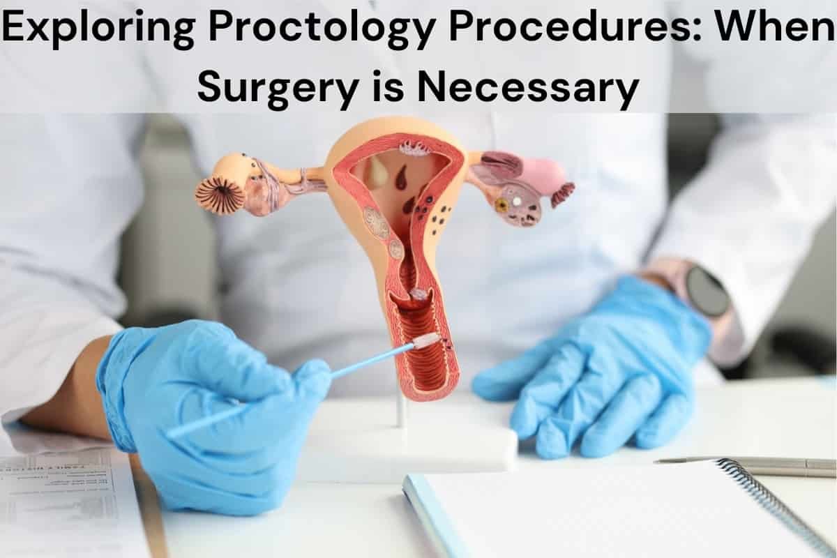 Exploring Proctology Procedures: When Surgery Is Necessary for Piles Treatment