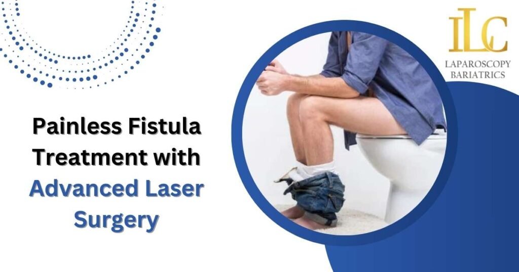 Painless Fistula Treatment with Advanced Laser Surgery in Indore