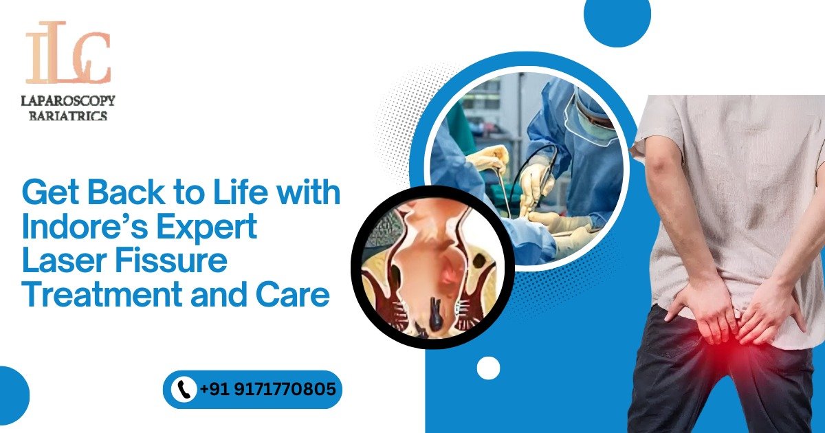 Get Back to Life with Indore’s Expert Laser Fissure Treatment and Care