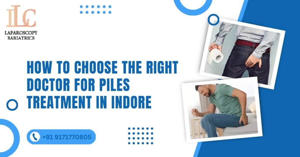 How to Choose the Right Doctor for Piles Treatment in Indore