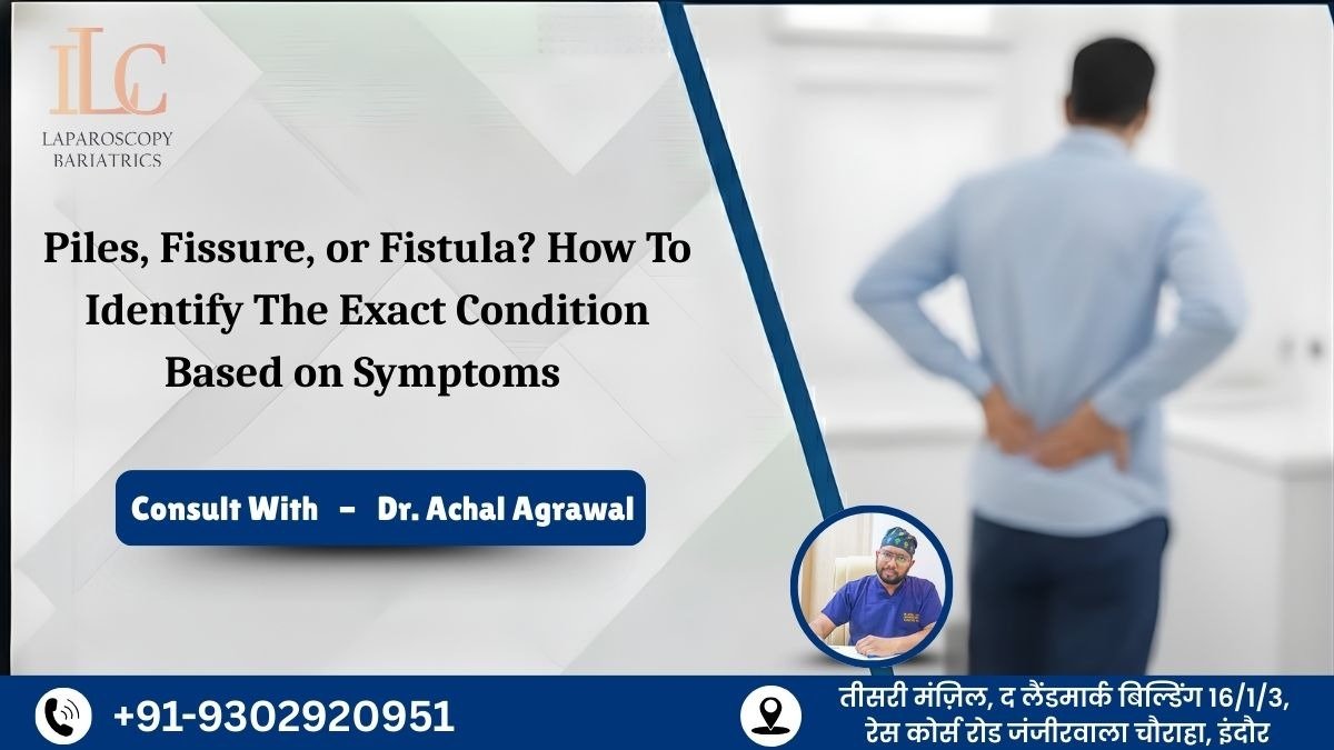 Piles, Fissure, or Fistula How to Identify the Exact Condition Based on Symptoms