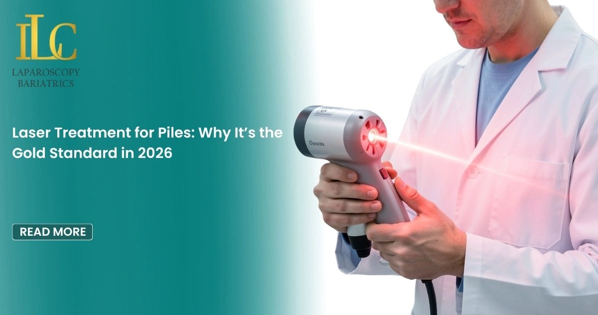 Laser Treatment for Piles Why It’s the Gold Standard in 2026