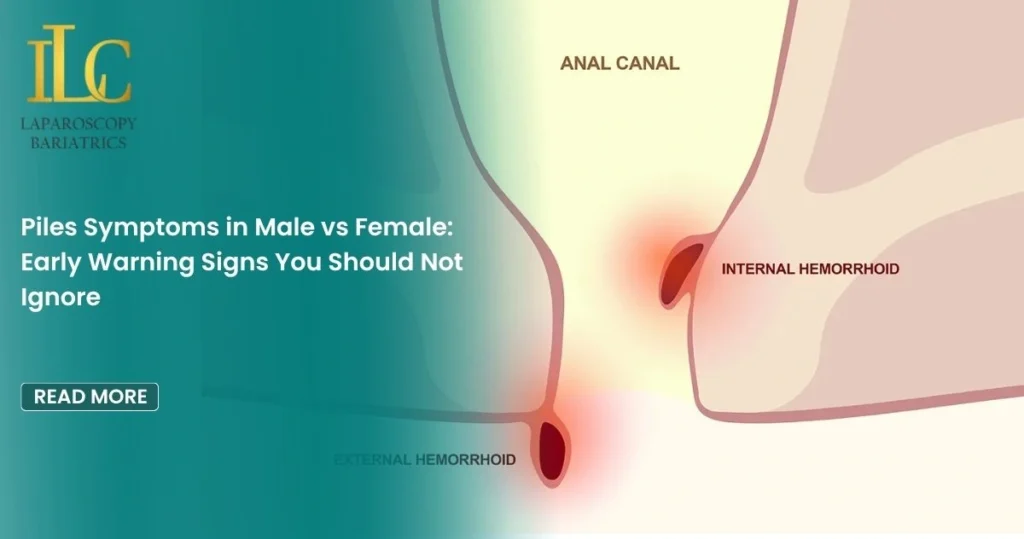 Piles Symptoms in Male vs Female: Early Warning Signs You Should Not Ignore