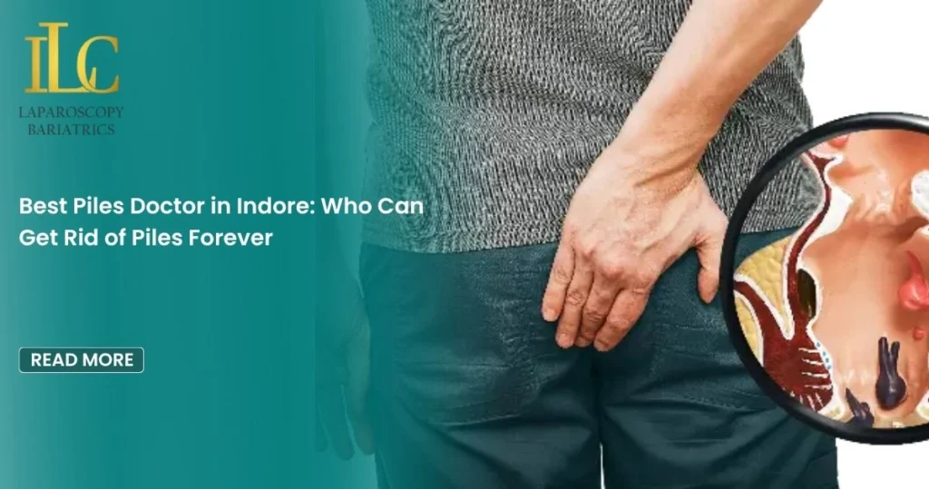 Best Piles Doctor in Indore: Who Can Get Rid of Piles Forever
