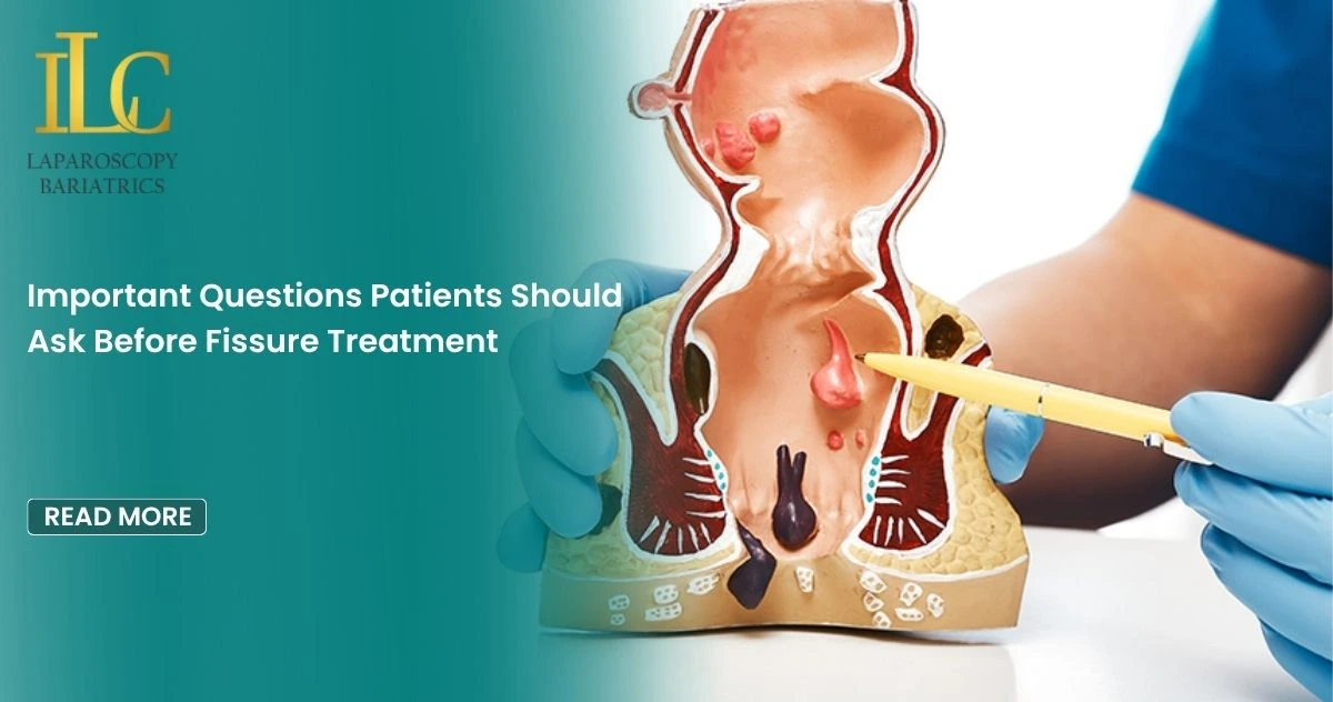 Important Questions Patients Should Ask Before Fissure Treatment
